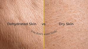 If Your Skin Is Oily, You Might Actually Be Dehydrated | Jasmine Skin Care